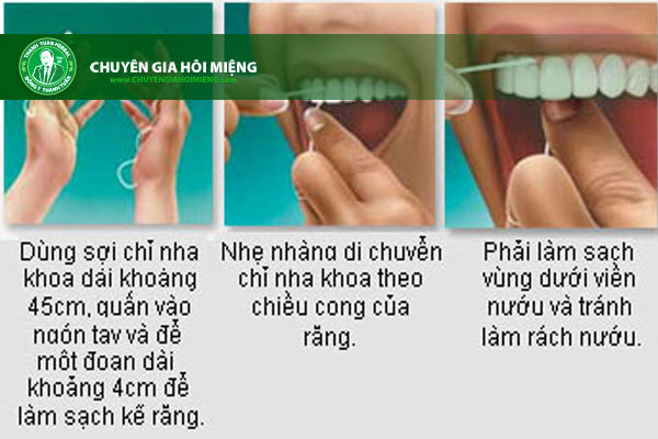 Dùng chỉ nha khoa để vệ sinh răng miệng giúp hơi thở thơm sạch.