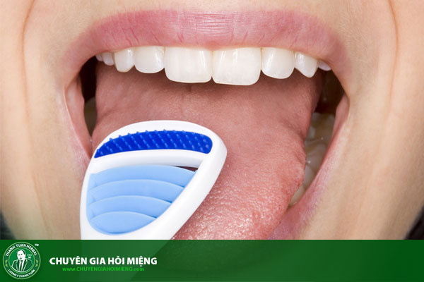 Làm gì khi bị hôi miệng - dùng đồ cạo lưỡi vệ sinh